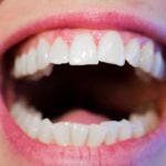 Ładne nienaganne zęby dodatkowo olśniewający prześliczny uśmieszek to powód do zadowolenia.